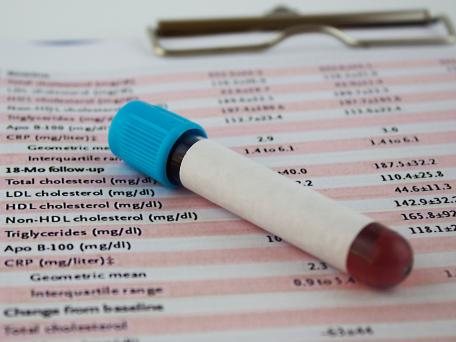 Blutröhrchen auf einem Laborbericht mit Messwerten zu Cholesterin, Triglyceriden und weiteren Blutwerten.
